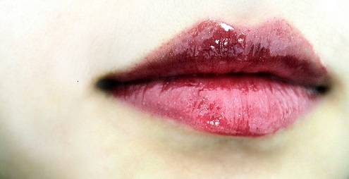 Lippen aufspritzen, Lippenkorrektur - proaesthetic